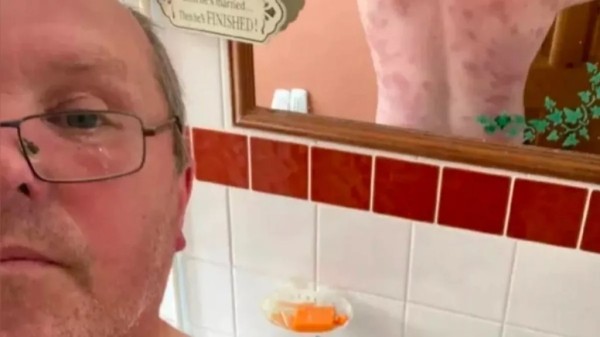 Мужчина выжил после 240 укусов ос Мужчина выжил после 240 укусов ос